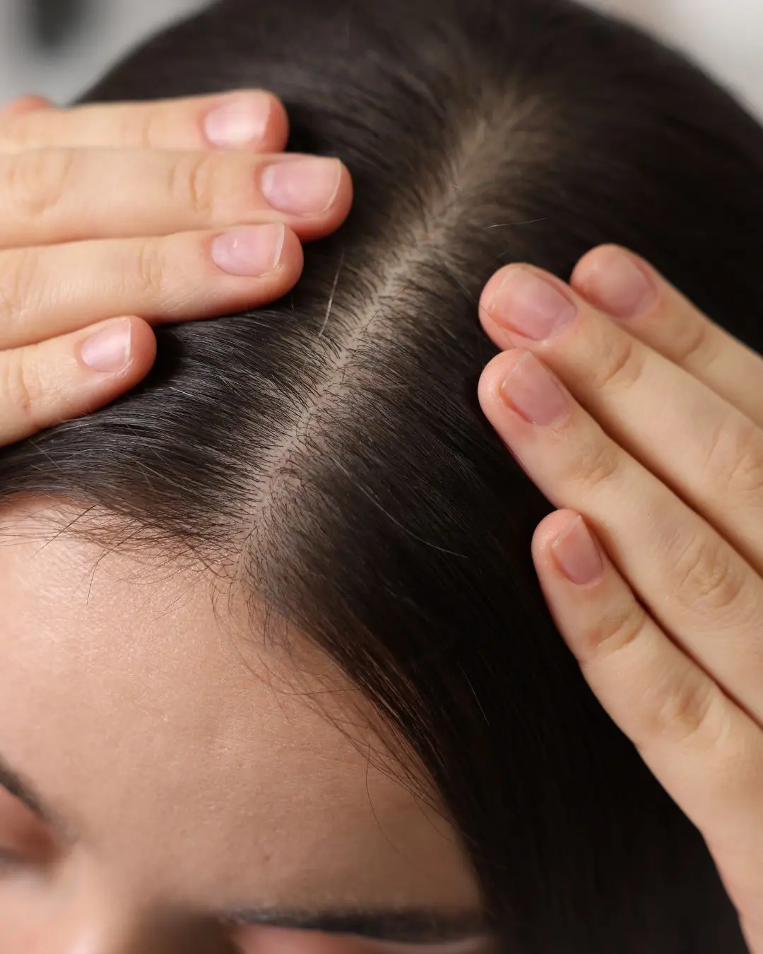 Tratamiento-organico-anticaida