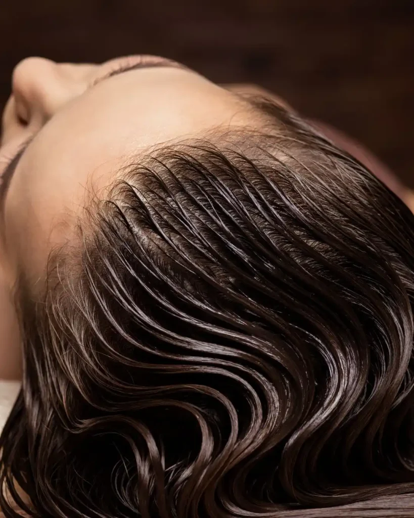 dermatitis-seborreica-tratamiento-natural