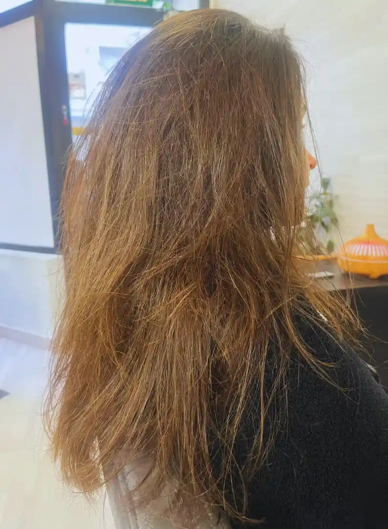 tratamiento-infinity-blue-antes