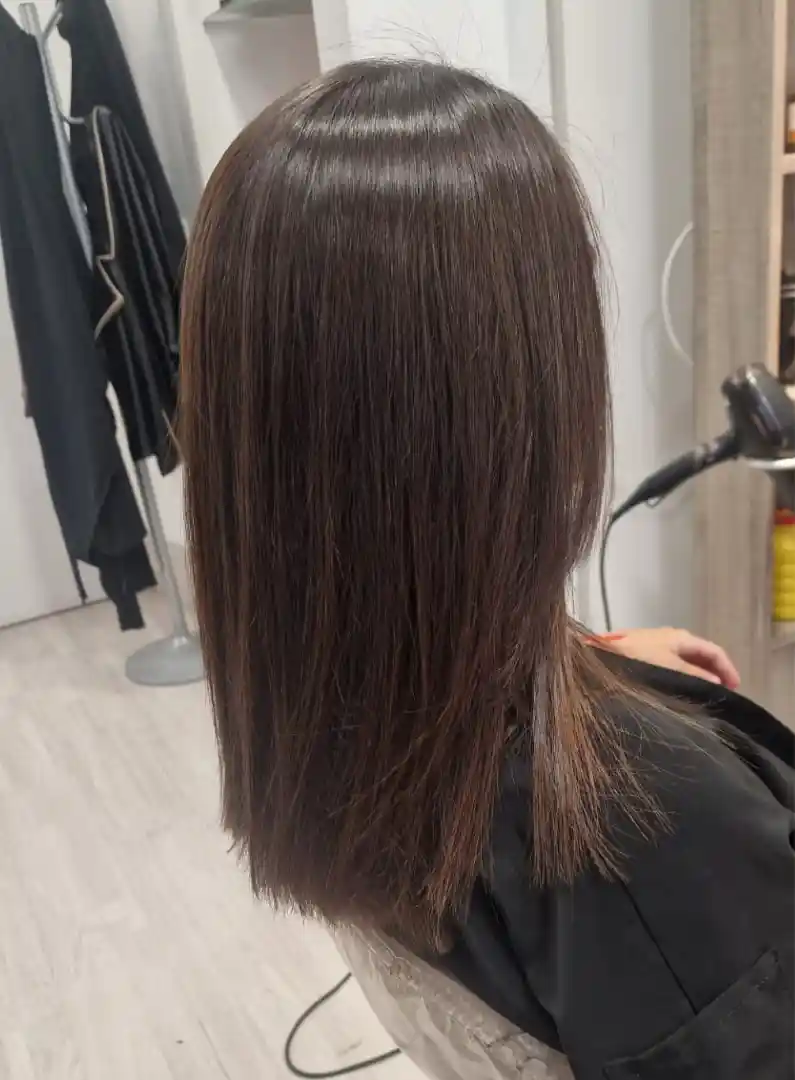 tratamiento-infinity-blue-despues